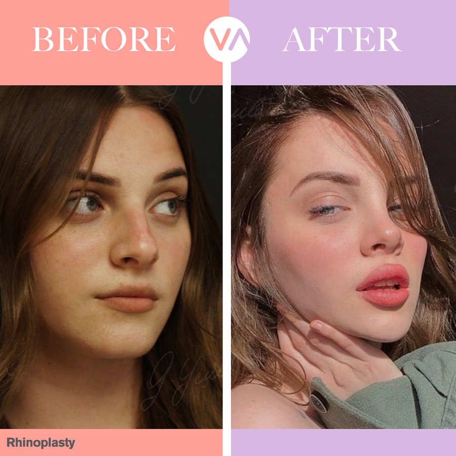 Vanity Cosmetic Surgery Hospital İstanbul - Vanity Cosmetic Surgery Hospital İstanbul