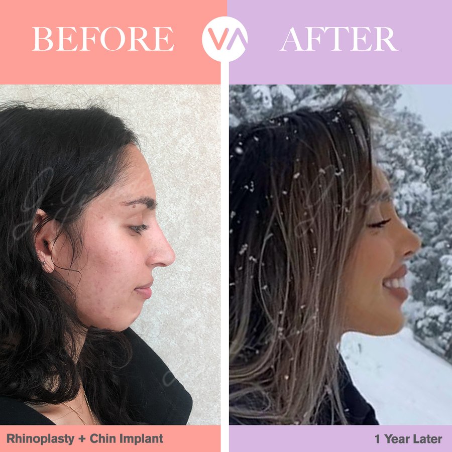 Vanity Cosmetic Surgery Hospital İstanbul - Vanity Cosmetic Surgery Hospital İstanbul