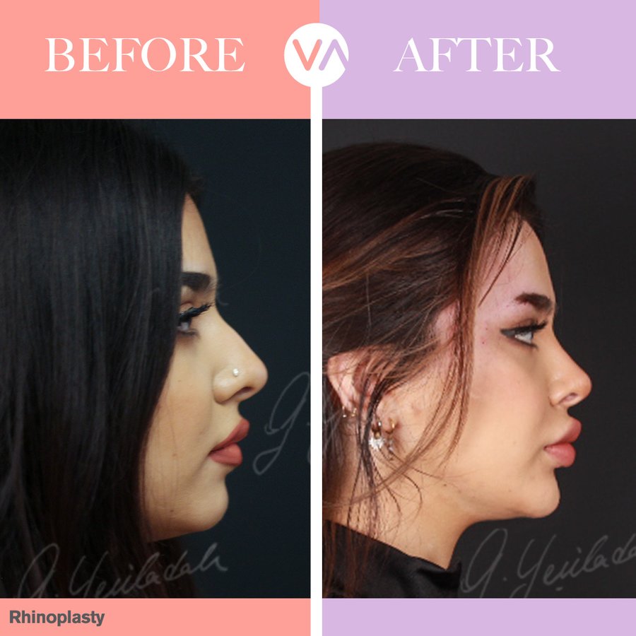 Vanity Cosmetic Surgery Hospital İstanbul - Vanity Cosmetic Surgery Hospital İstanbul