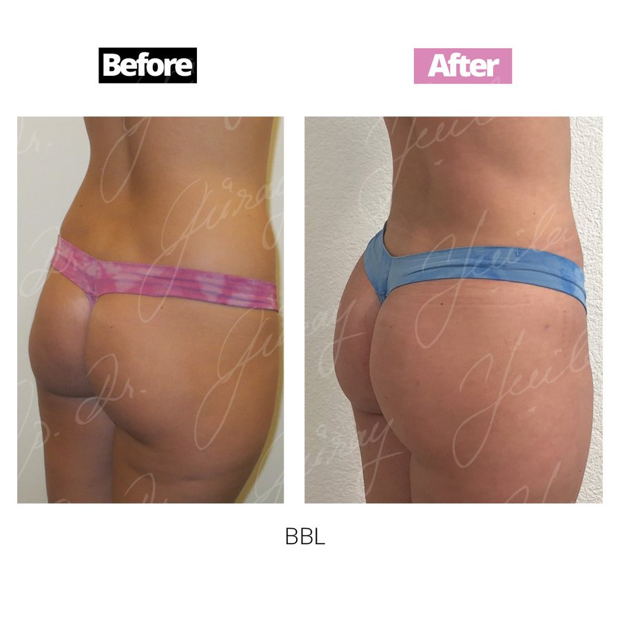 Vanity Cosmetic Surgery Hospital İstanbul - Vanity Cosmetic Surgery Hospital İstanbul