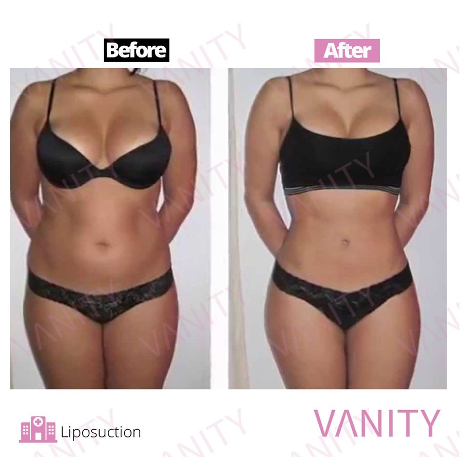 Vanity Cosmetic Surgery Hospital İstanbul - Vanity Cosmetic Surgery Hospital İstanbul