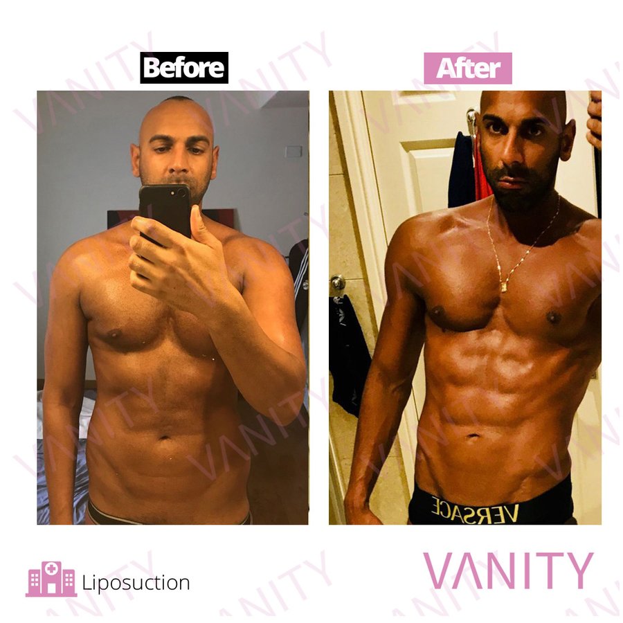 Vanity Cosmetic Surgery Hospital İstanbul - Vanity Cosmetic Surgery Hospital İstanbul