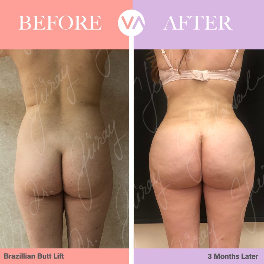 Vanity Cosmetic Surgery Hospital İstanbul - Vanity Cosmetic Surgery Hospital İstanbul