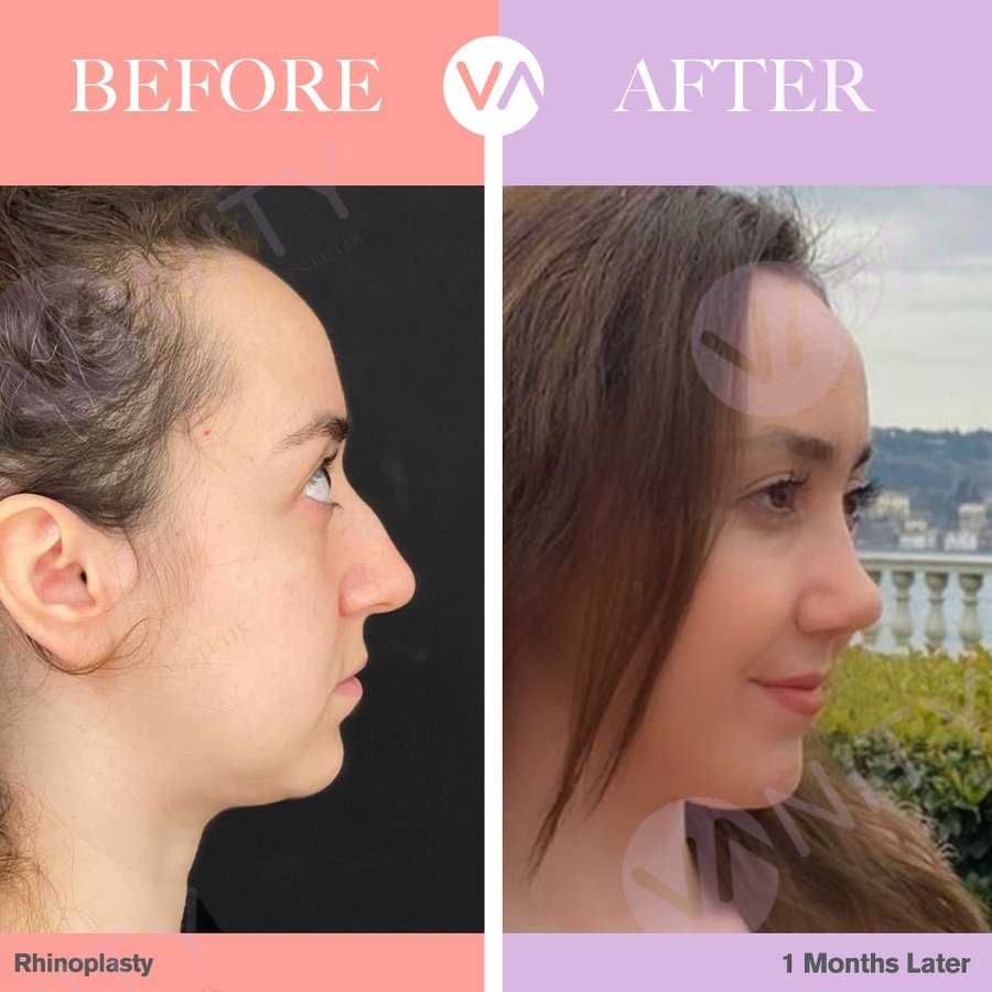 Vanity Cosmetic Surgery Hospital İstanbul - Vanity Cosmetic Surgery Hospital İstanbul