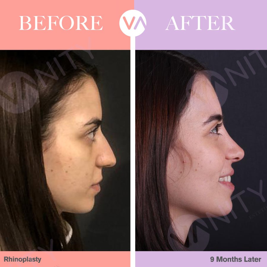 Vanity Cosmetic Surgery Hospital İstanbul - Vanity Cosmetic Surgery Hospital İstanbul