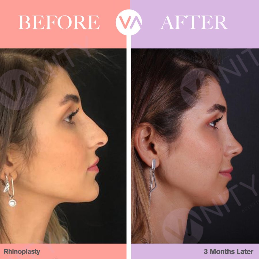 Vanity Cosmetic Surgery Hospital İstanbul - Vanity Cosmetic Surgery Hospital İstanbul