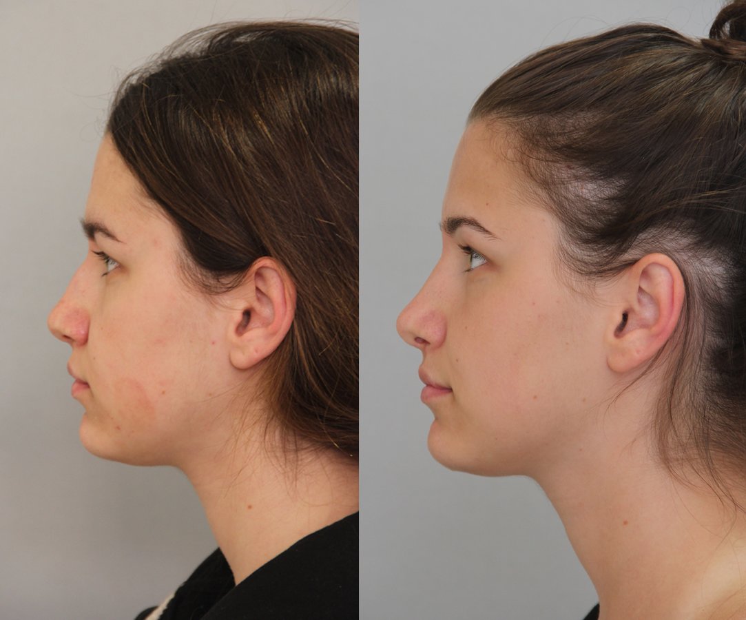 Vanity Cosmetic Surgery Hospital İstanbul - Vanity Cosmetic Surgery Hospital İstanbul