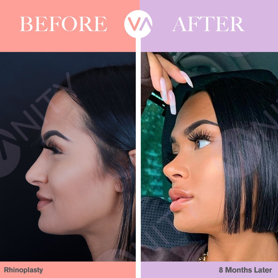 Vanity Cosmetic Surgery Hospital İstanbul - Vanity Cosmetic Surgery Hospital İstanbul