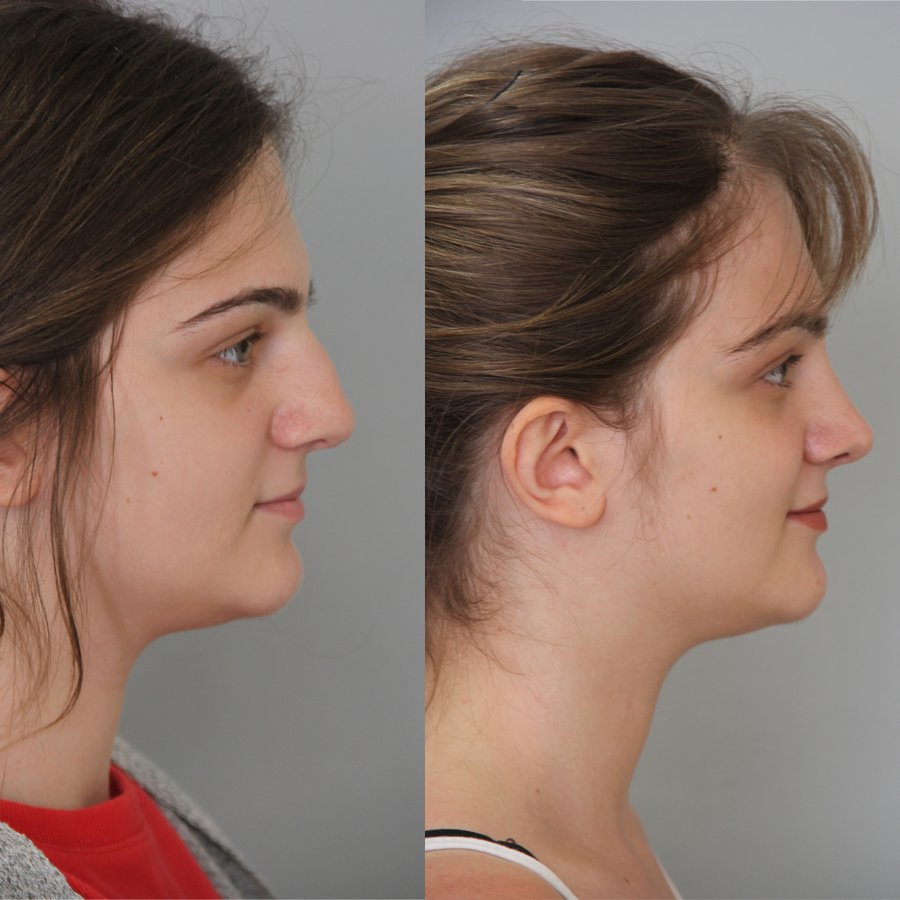 Vanity Cosmetic Surgery Hospital İstanbul - Vanity Cosmetic Surgery Hospital İstanbul