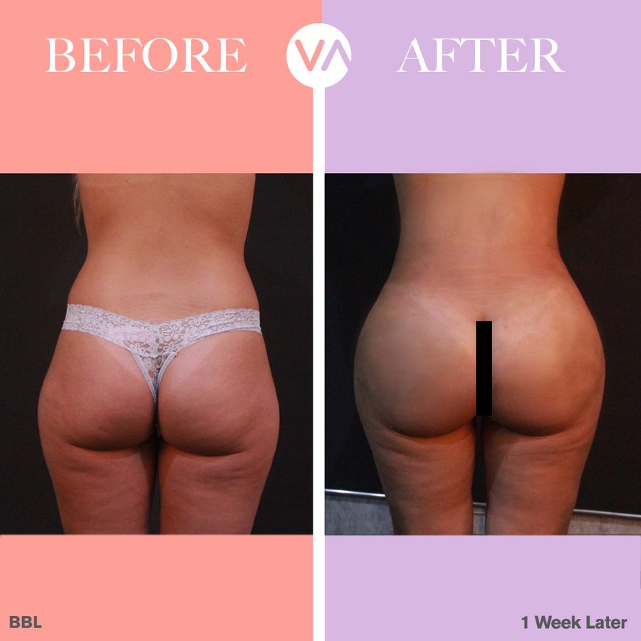 Vanity Cosmetic Surgery Hospital İstanbul - Vanity Cosmetic Surgery Hospital İstanbul