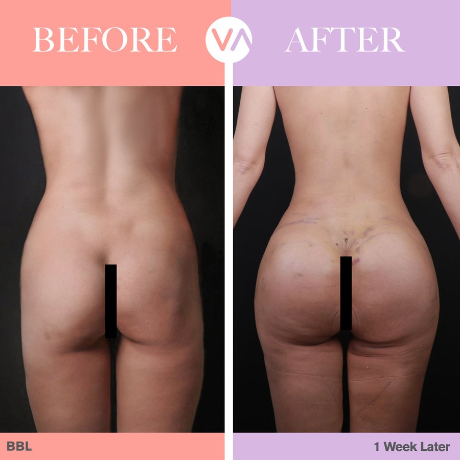 Vanity Cosmetic Surgery Hospital İstanbul - Vanity Cosmetic Surgery Hospital İstanbul