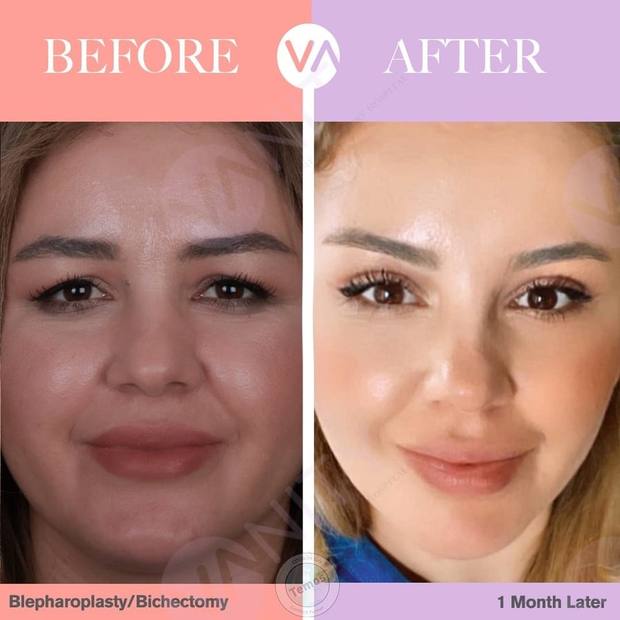 Vanity Cosmetic Surgery Hospital İstanbul - Vanity Cosmetic Surgery Hospital İstanbul