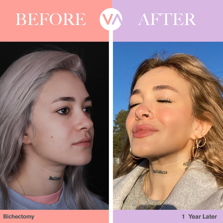 Vanity Cosmetic Surgery Hospital İstanbul - Vanity Cosmetic Surgery Hospital İstanbul