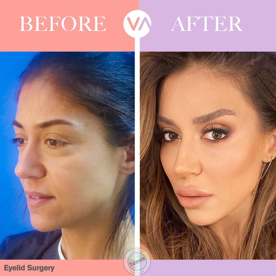Vanity Cosmetic Surgery Hospital İstanbul - Vanity Cosmetic Surgery Hospital İstanbul
