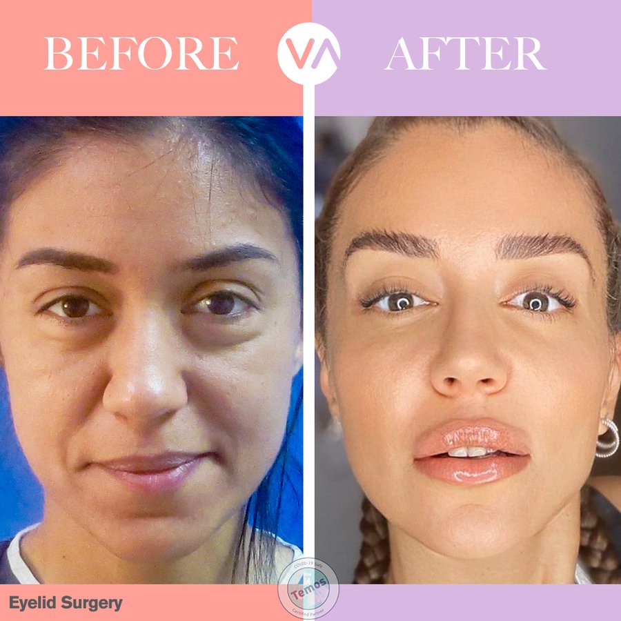 Vanity Cosmetic Surgery Hospital İstanbul - Vanity Cosmetic Surgery Hospital İstanbul