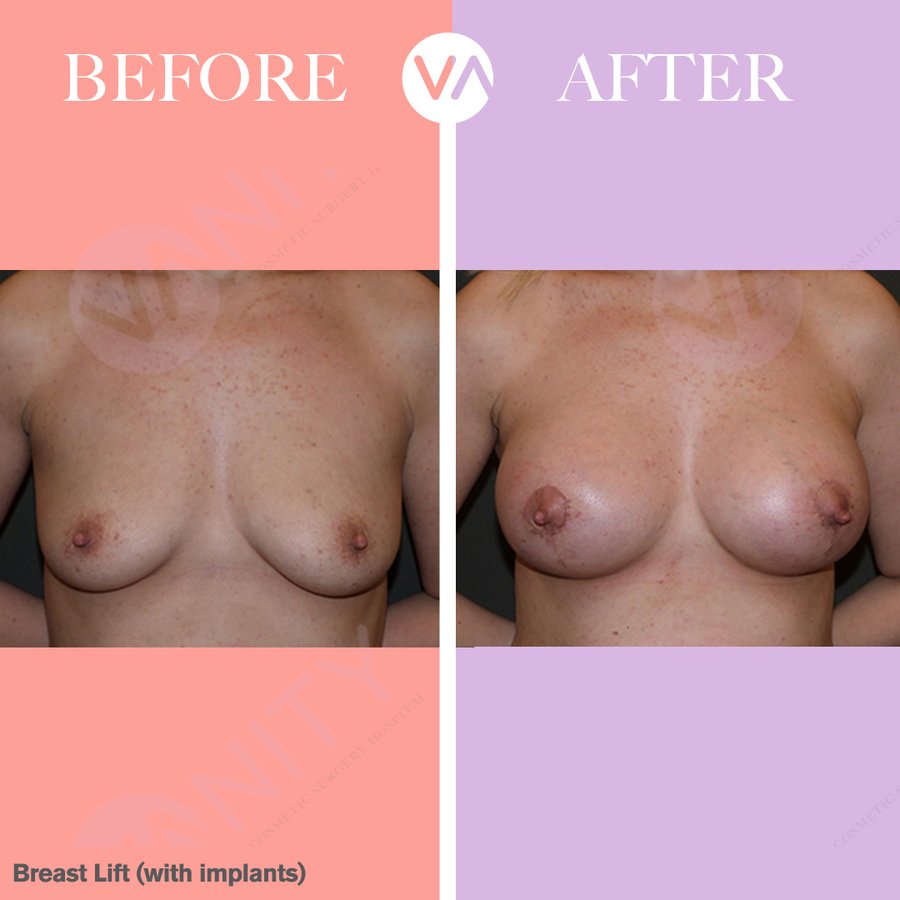 Vanity Cosmetic Surgery Hospital İstanbul - Vanity Cosmetic Surgery Hospital İstanbul