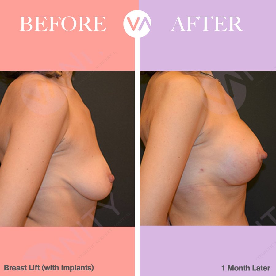 Vanity Cosmetic Surgery Hospital İstanbul - Vanity Cosmetic Surgery Hospital İstanbul