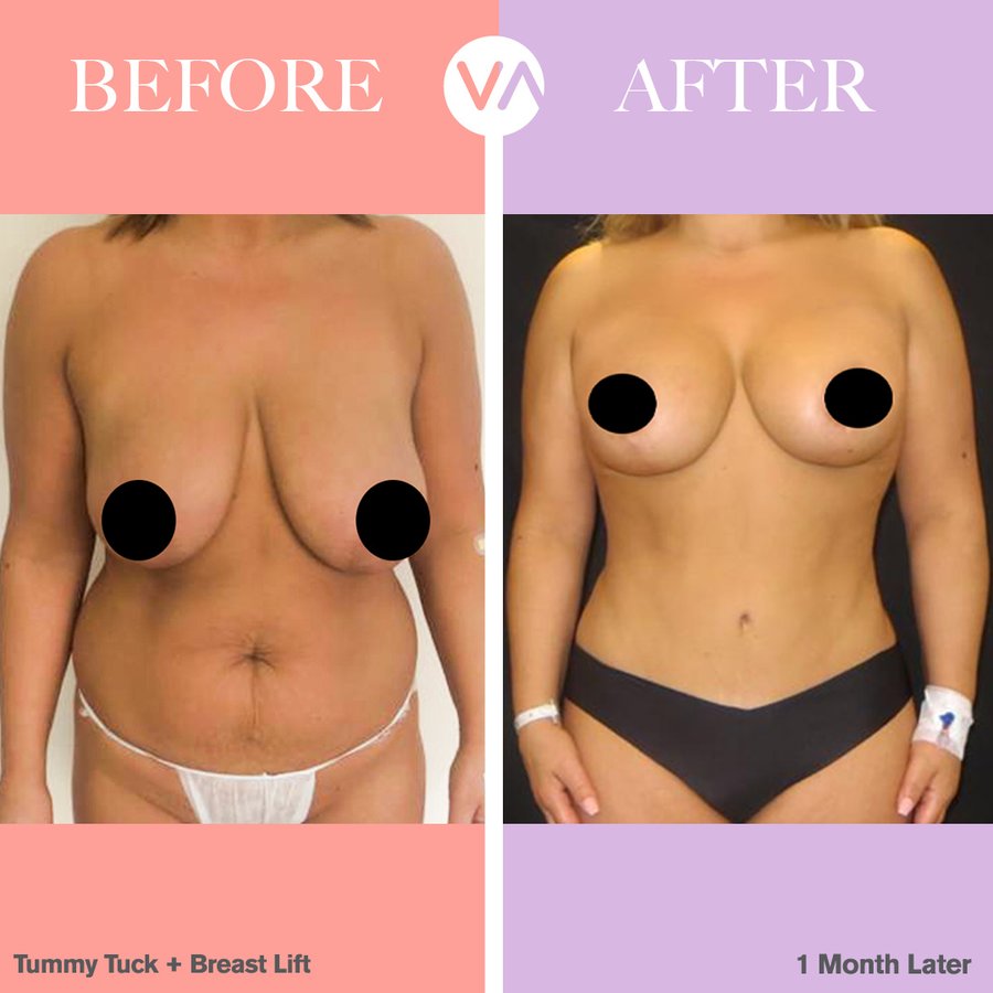 Vanity Cosmetic Surgery Hospital İstanbul - Vanity Cosmetic Surgery Hospital İstanbul