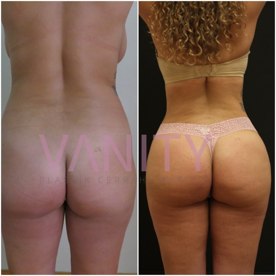 Vanity Cosmetic Surgery Hospital İstanbul - Vanity Cosmetic Surgery Hospital İstanbul