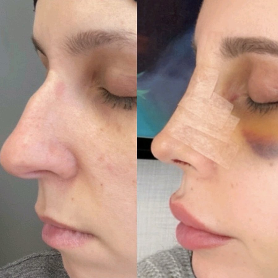 Vanity Cosmetic Surgery Hospital İstanbul - Vanity Cosmetic Surgery Hospital İstanbul