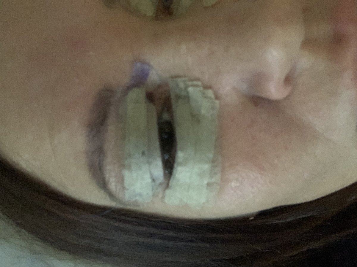 Vanity Cosmetic Surgery Hospital İstanbul - Vanity Cosmetic Surgery Hospital İstanbul