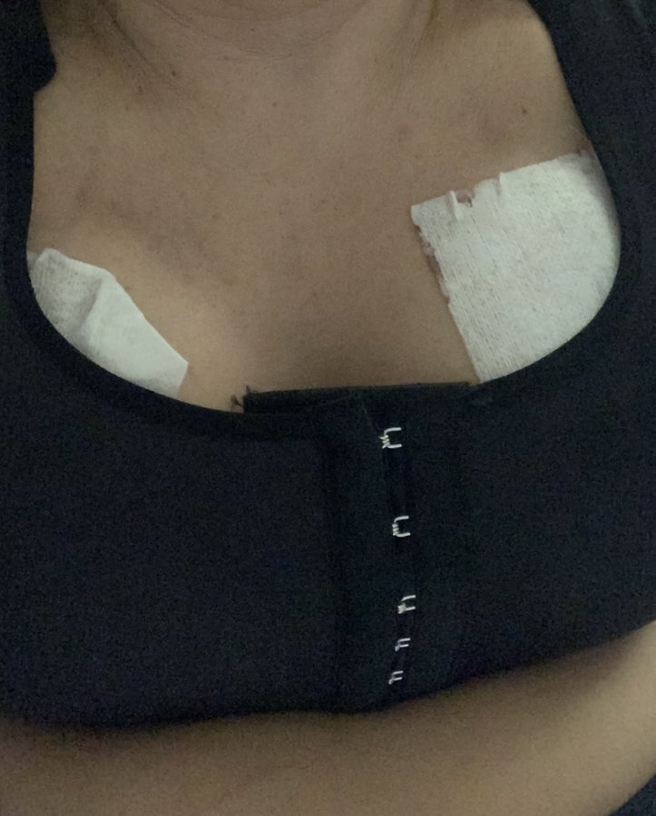 Vanity Cosmetic Surgery Hospital İstanbul - Vanity Cosmetic Surgery Hospital İstanbul