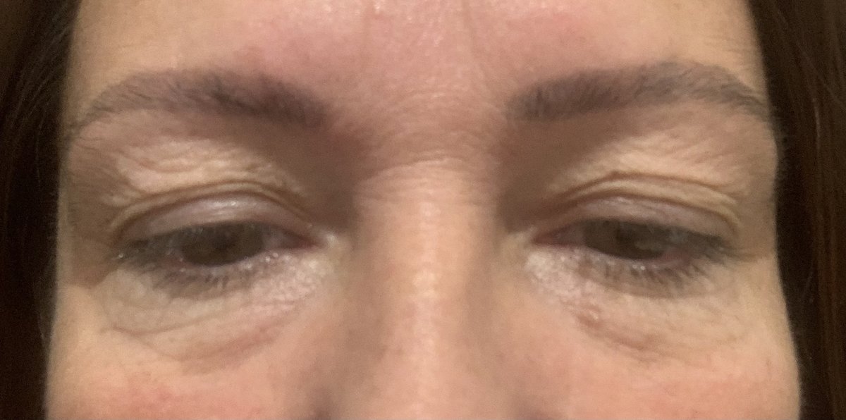 Vanity Cosmetic Surgery Hospital İstanbul - Vanity Cosmetic Surgery Hospital İstanbul