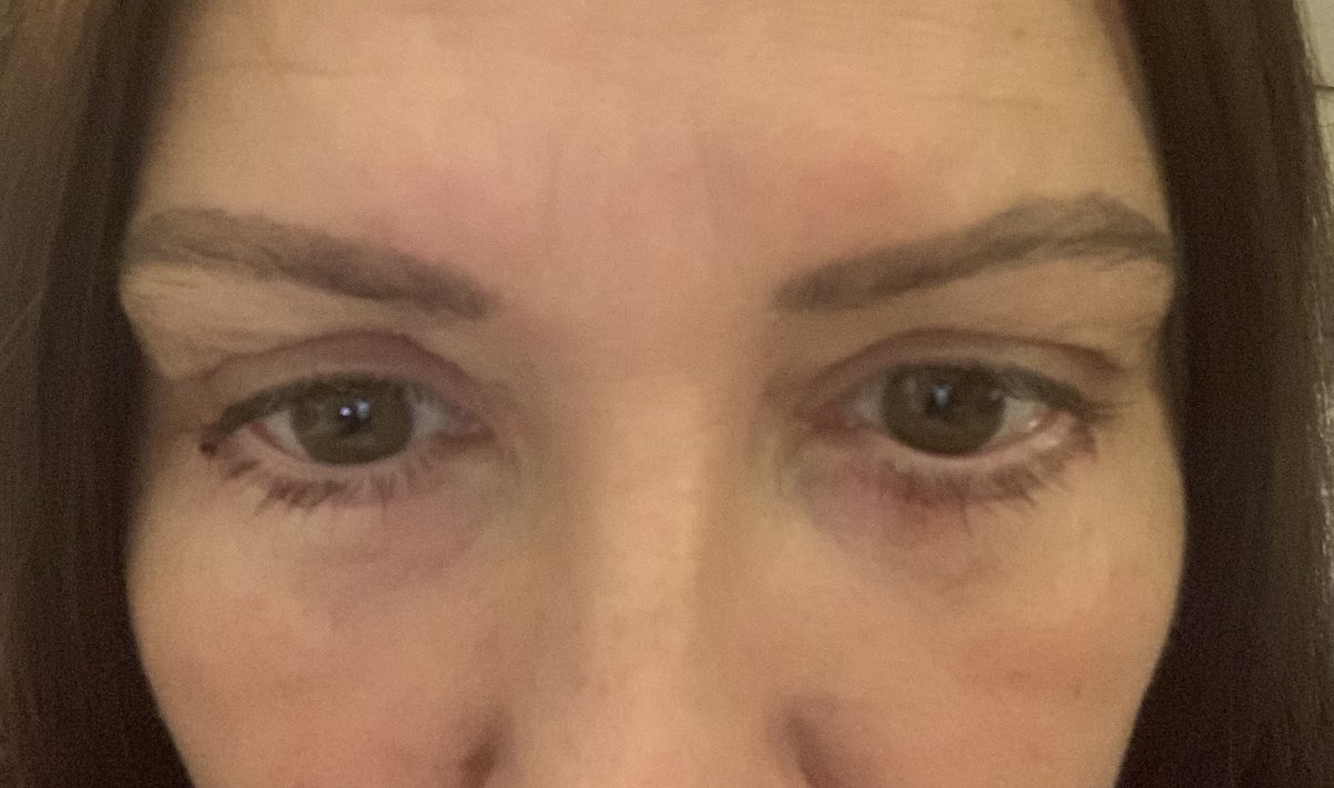 Vanity Cosmetic Surgery Hospital İstanbul - Vanity Cosmetic Surgery Hospital İstanbul