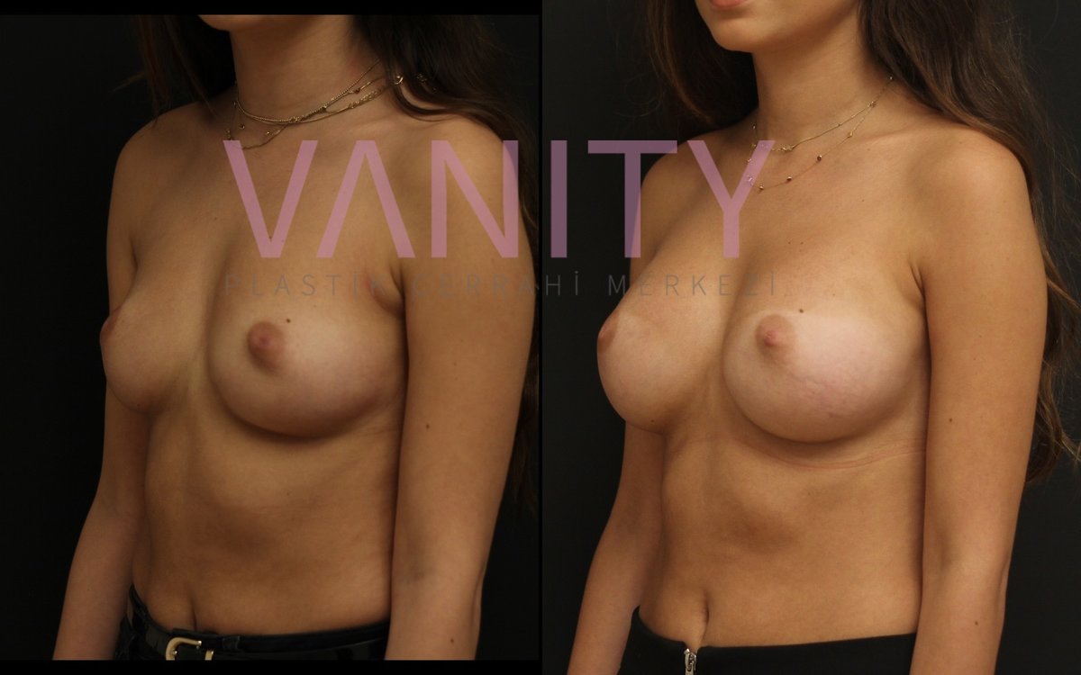 Vanity Cosmetic Surgery Hospital İstanbul - Vanity Cosmetic Surgery Hospital İstanbul