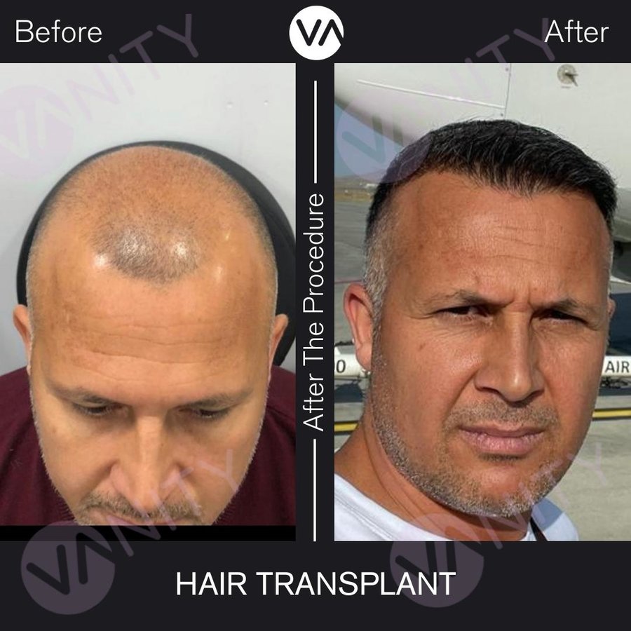Vanity Hair - Vanity Hair