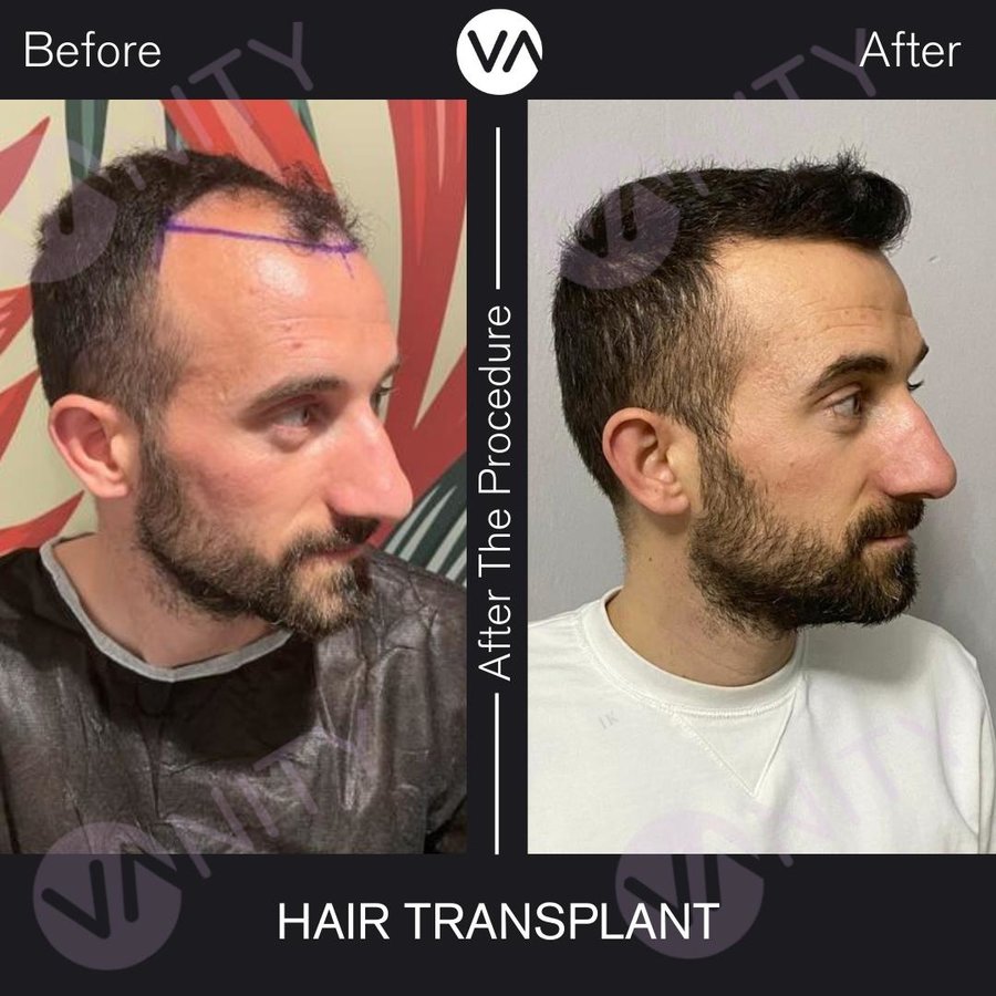 Vanity Hair - Vanity Hair