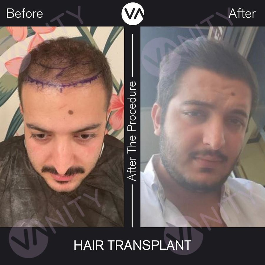Vanity Hair - Vanity Hair