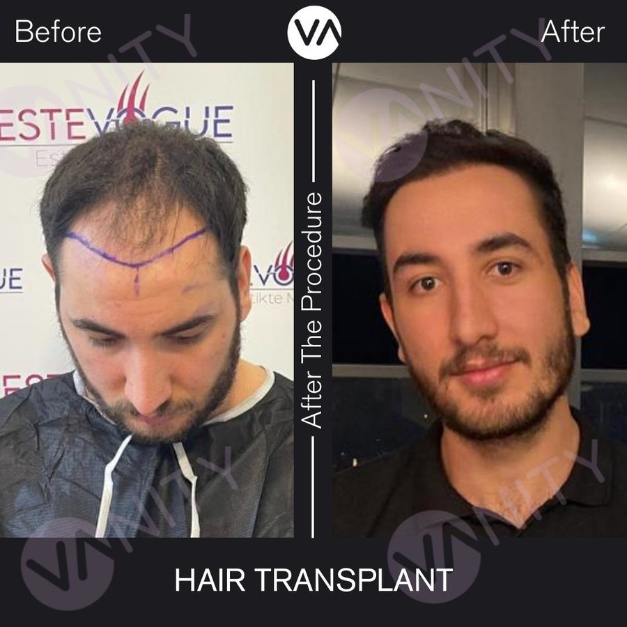 Vanity Hair - Vanity Hair