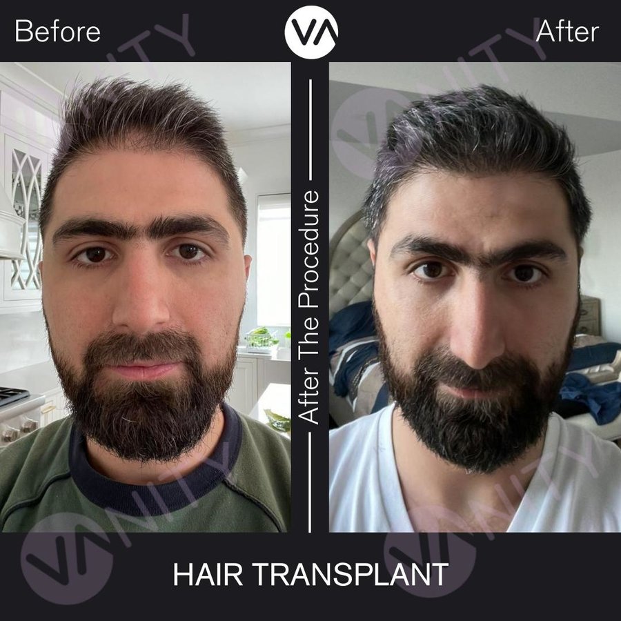 Vanity Hair - Vanity Hair