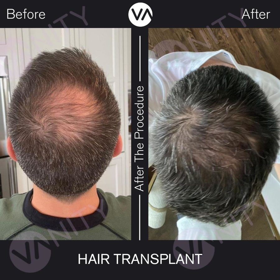 Vanity Hair - Vanity Hair