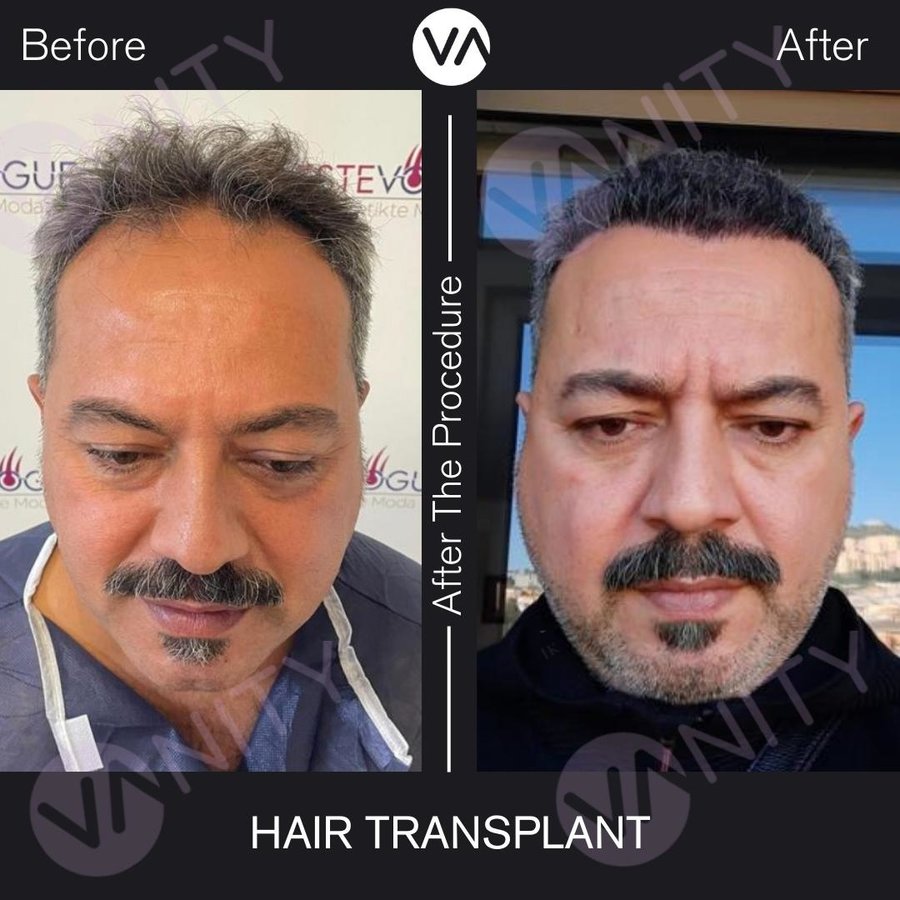 Vanity Hair - Vanity Hair