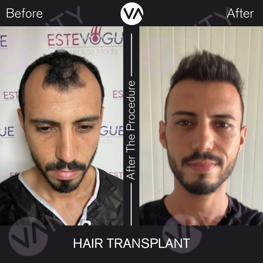 Vanity Hair - Vanity Hair