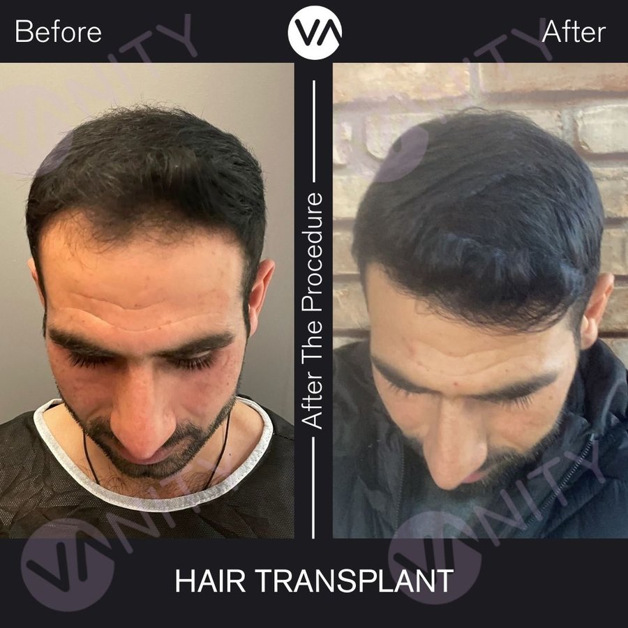 Vanity Hair - Vanity Hair