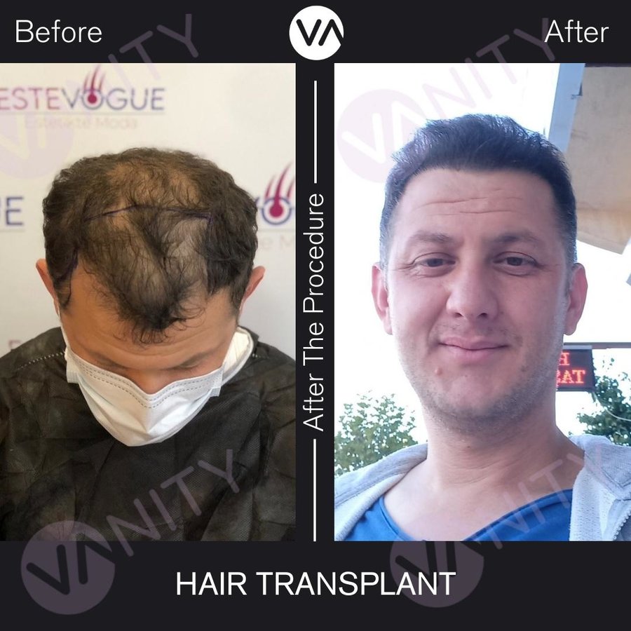 Vanity Hair - Vanity Hair