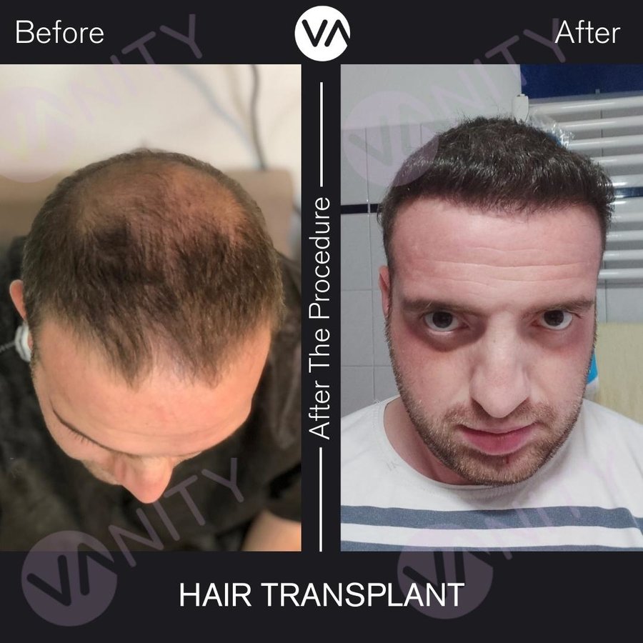 Vanity Hair - Vanity Hair