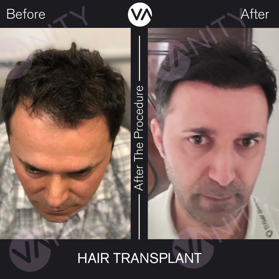 Vanity Hair - Vanity Hair