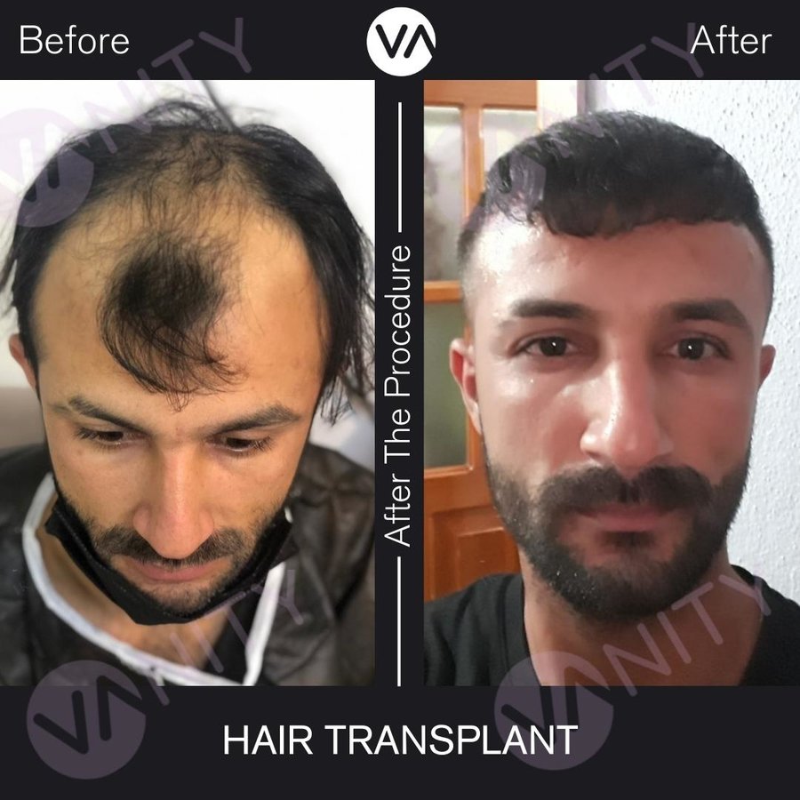 Vanity Hair - Vanity Hair