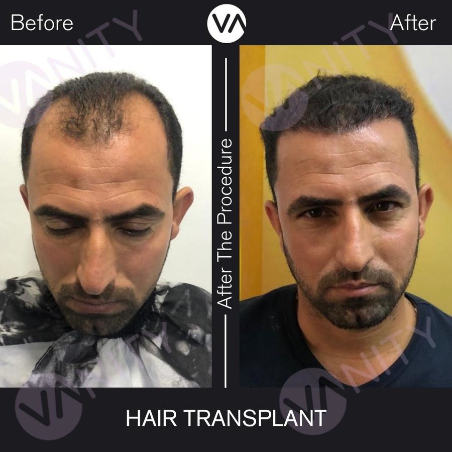 Vanity Hair - Vanity Hair