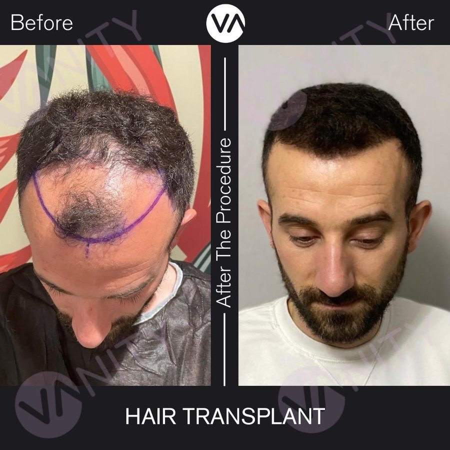 Vanity Hair - Vanity Hair