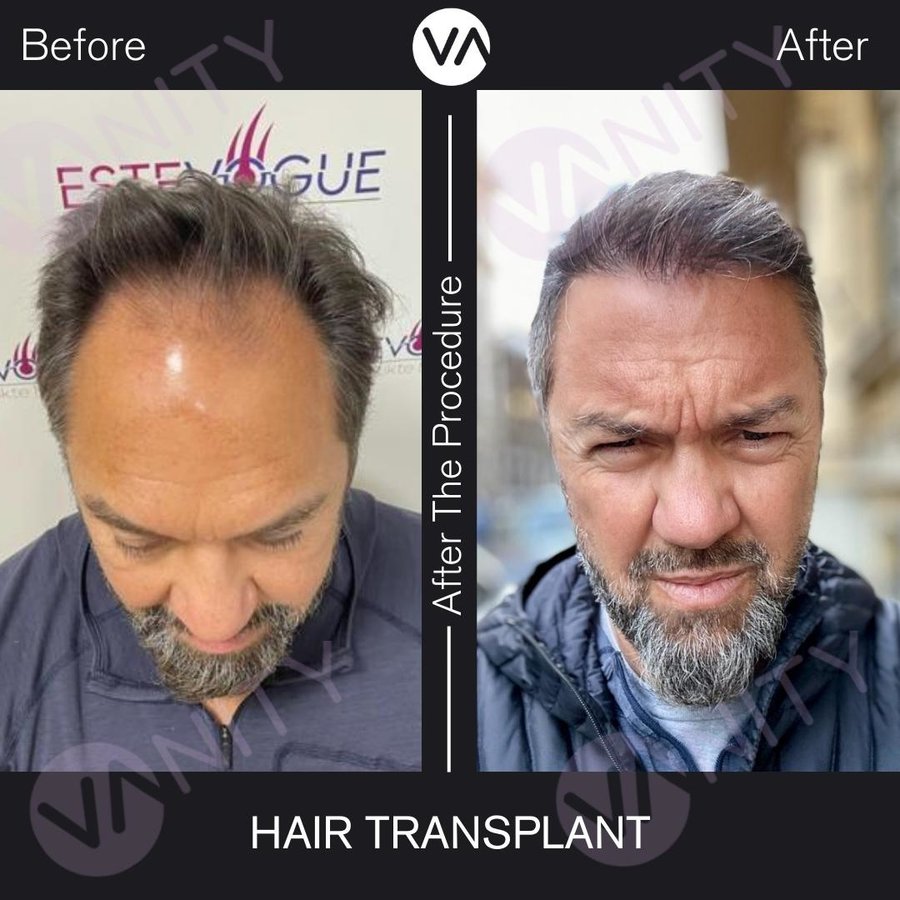 Vanity Hair - Vanity Hair