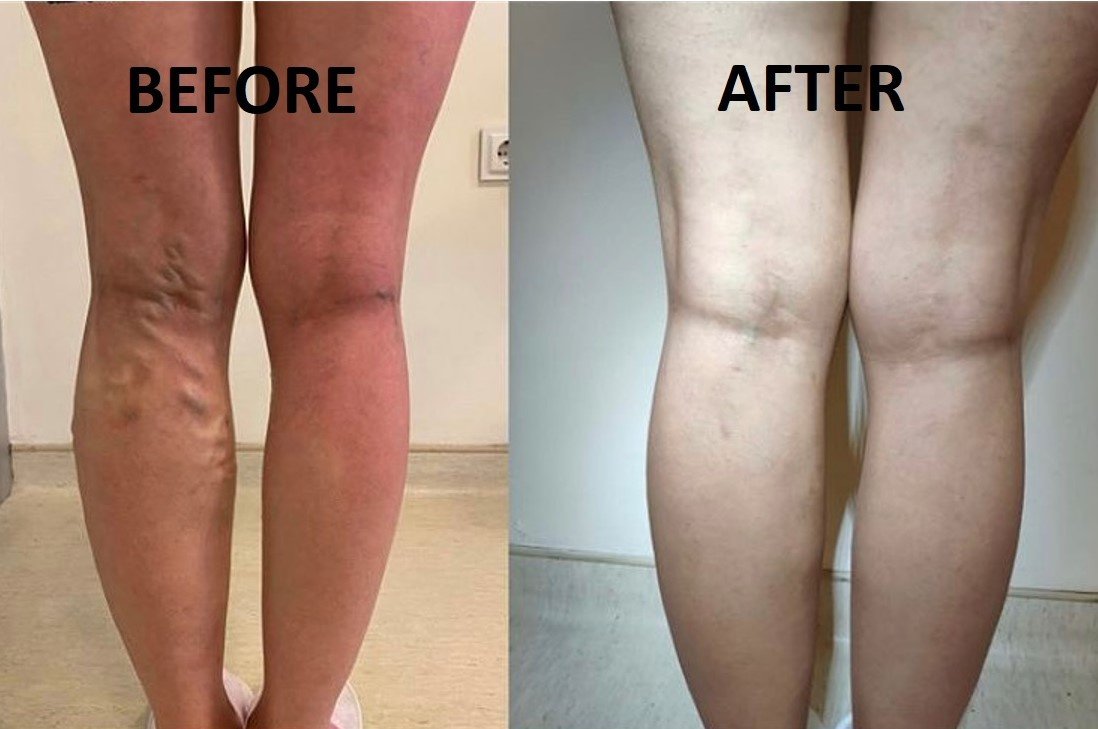 Varisson Interventional Radiology Center - Varisson Interventional Radiology Center