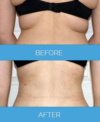 عيادة فيزر - برمنغهام - Vaser Clinic - Birmingham