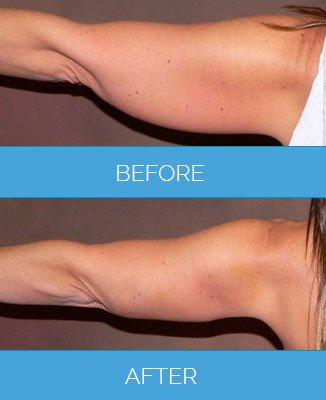 عيادة فيزر - برمنغهام - Vaser Clinic - Birmingham