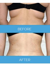عيادة فيزر - برمنغهام - Vaser Clinic - Birmingham