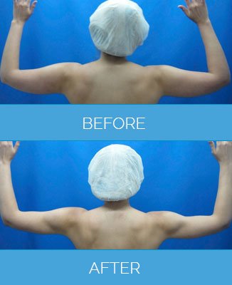 Vaser Clinic - Liverpool - Vaser Clinic - Liverpool